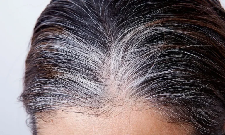 Como reverter cabelos brancos naturalmente com vitaminas? 1 Como-reverter-cabelos-brancos-naturalmente-com-vitaminas